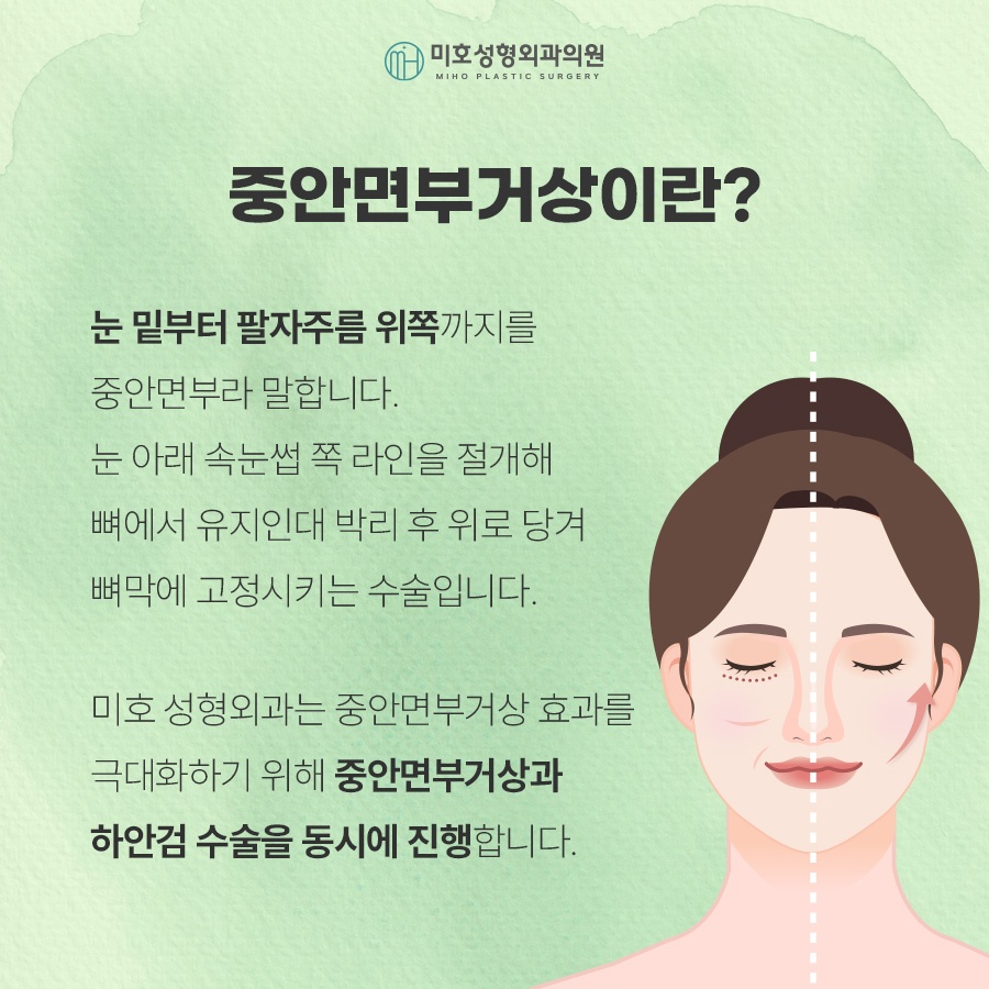 중안면거상 노화 증상에 주목하여 관련 이미지 2