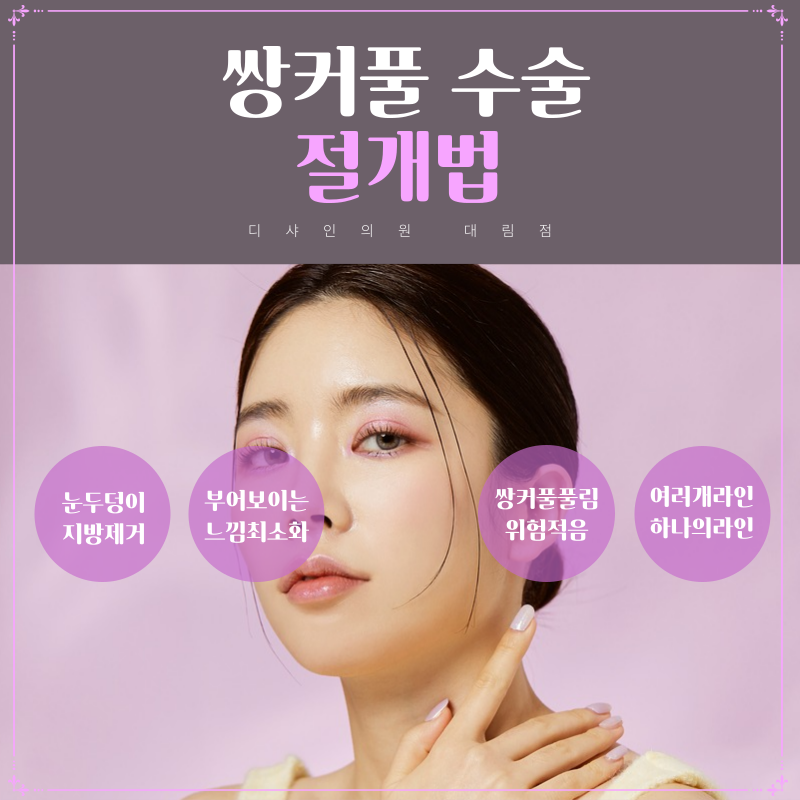 쌍커플은 어떤 방법으로 수술할까? 관련 이미지 3