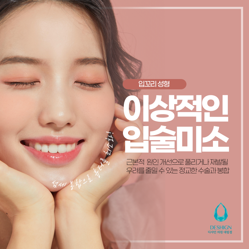 입꼬리 성형, 좋은 인상을 심어줄 수 있어요~ 관련 이미지 3