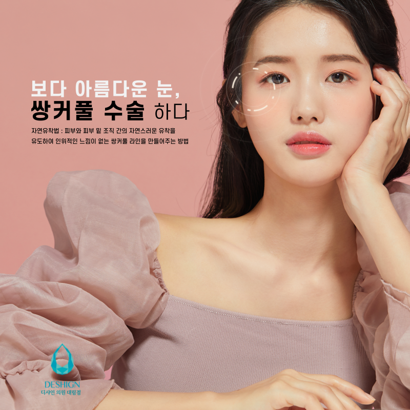 쌍커풀 수술, 어떤 방법이 나에게 맞을까? 관련 이미지 2