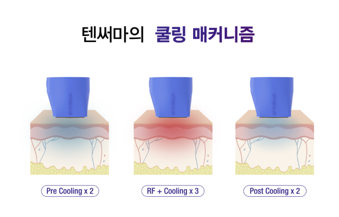 🔍텐써마,받아도 될까?고민된다면 클릭! 관련 이미지 4