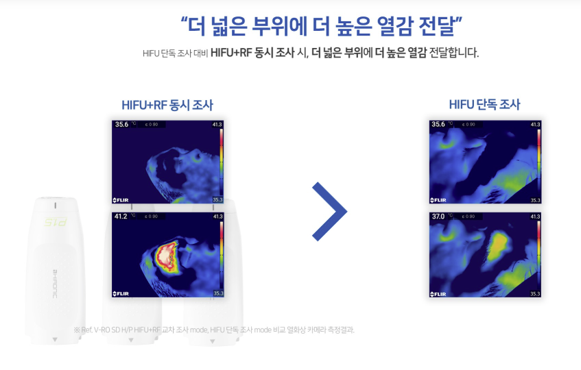 브이로 리프팅으로 관련 이미지 2