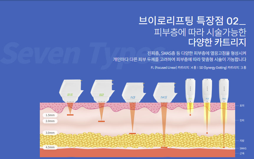 브이로 리프팅으로 관련 이미지 4