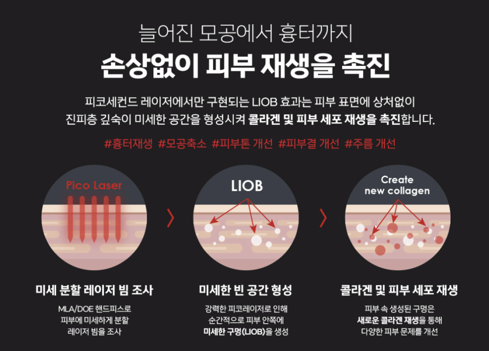🖤 피코라이트 블랙(Picolite Black) 관련 이미지 2