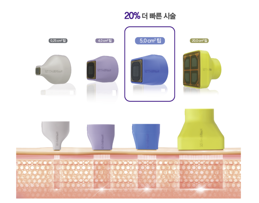 🔍텐써마,받아도 될까?고민된다면 클릭! 관련 이미지 2