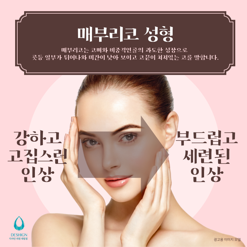 균형을 맞춘 밸런스 코성형 관련 이미지 3