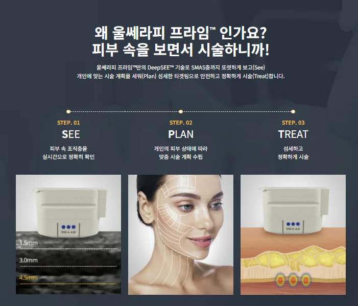 울쎄라피 프라임(ULTHERAPY PRIME®), 기존 울쎄라와 무엇이 달라졌을까요? 관련 이미지 3
