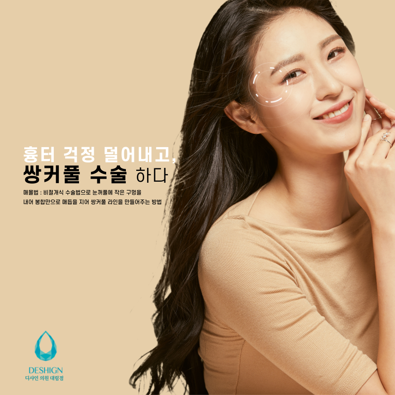 쌍커풀 수술, 어떤 방법이 나에게 맞을까? 관련 이미지 3