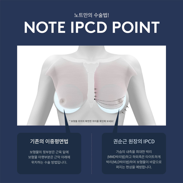 자연스러우면서도 아름다운 가슴을 위한 방법은? 관련 이미지 6