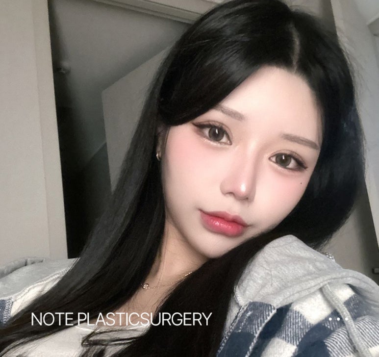 Gangnam canthoplasty clinic, Note Plastic Surgery’s epicanthoplasty, canthoplasty, lower canthoplasty, and canthoplasty procedures image 7