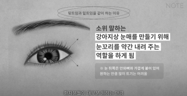 Double Eyelid Surgery: Is There a Procedure That Makes the Eyes Even Prettier When Done Together? A Great Place for Eye Plastic Surgery in Gangnam — NOTE Plastic Surgery: Canthoplasty, Ptosis Correction, and Forehead Lift image 25