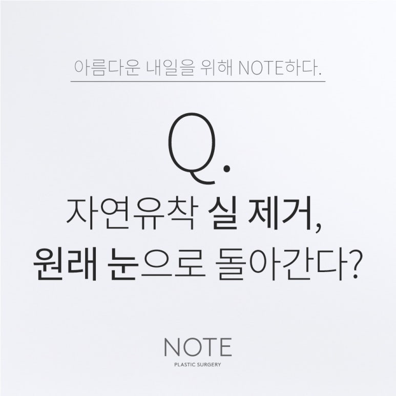 강남 쌍수 자연유착 눈성형 잘하는 곳 추천 논현 노트성형외과의 자연유착 실 제거, 원래 눈으로 돌아갈까요? 관련 이미지 1