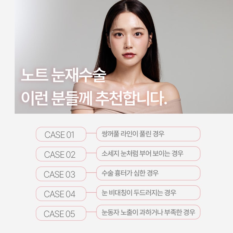 A Review of Revision Eyelid Surgery That Speaks for Itself: A Famous Eyelid Surgery Clinic Near Nonhyeon Station, Note Plastic Surgery’s Final Revision Eyelid Surgery Recommendations and Case Explanations image 8