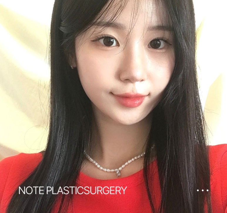 The choice for your final eye surgery! Recommended revision double eyelid surgery at Note Plastic Surgery, a revision eye surgery clinic in Nonhyeon image 6