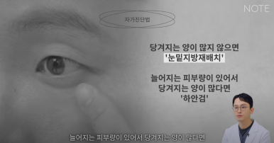 논현 눈수술 성형외과 유명한 곳 눈밑지방재배치 추천 강남 노트성형외과의 눈밑지하안검을 구분하는 자가진단법? 관련 이미지 7