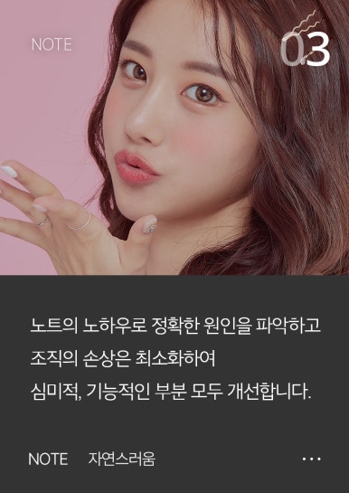 쌍꺼풀 수술보다 쌍수재수술이 더 어렵다? 강남 눈재수술 잘하는 곳 노트성형외과 관련 이미지 4