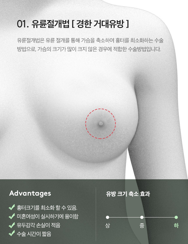 [Note Plastic Surgery] Let’s Learn About Breast Reduction! image 6