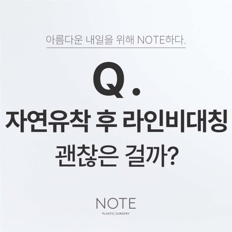 강남 눈성형수술 쌍수 자연유착 잘하는 곳 논현역 눈성형외과 노트성형외과의 자연유착 쌍꺼풀수술 관련 이미지 1