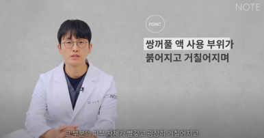Why Not to Use Double-Eyelid Glue or Tape Before Natural Adhesion Non-Incisional Double-Eyelid Surgery, According to Note Plastic Surgery in Nonhyeon, a Gangnam Eye Surgery Clinic Known for Doing Double Eyelid Surgery Well image 12