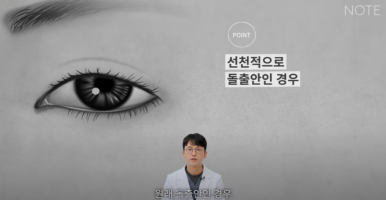 꺼진 눈이 생기는 이유는 따로 있다? 강남 눈성형 잘하는 곳 추천 노트성형외과의 눈꺼짐 해결을 위한 쌍커풀성형과 눈매교정, 지방이식수술 관련 이미지 22