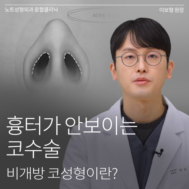Recommended Gangnam Rhinoplasty Clinic: What Is Non-Open Rhinoplasty, as Explained by Note Plastic Surgery in Nonhyeon, a Place Known for Good Nose Surgery? image 1