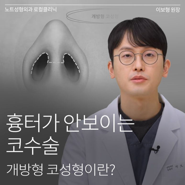 논현 코수술 코성형 유명한 곳 추천 강남 노트성형외과가 말하는 개방 코성형이란? 관련 이미지 1