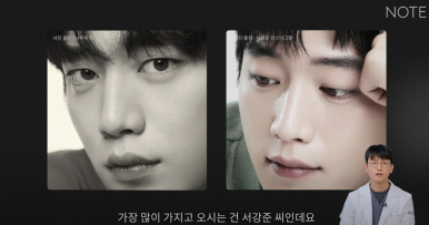 Male Eye Surgery: If You’re Not Sure Which Double Eyelid Suits You, Preview of Note Plastic Surgery’s Male Monolid Double-Eyelid Line Surgery Method at Nonhyeon Station, a Place Known for Male Eye Surgery! image 9
