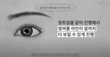 Double Eyelid Surgery: Is There a Procedure That Makes the Eyes Even Prettier When Done Together? A Great Place for Eye Plastic Surgery in Gangnam — NOTE Plastic Surgery: Canthoplasty, Ptosis Correction, and Forehead Lift image 19