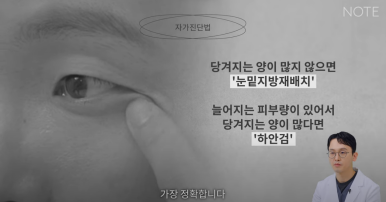 논현 눈수술 성형외과 유명한 곳 눈밑지방재배치 추천 강남 노트성형외과의 눈밑지하안검을 구분하는 자가진단법? 관련 이미지 11
