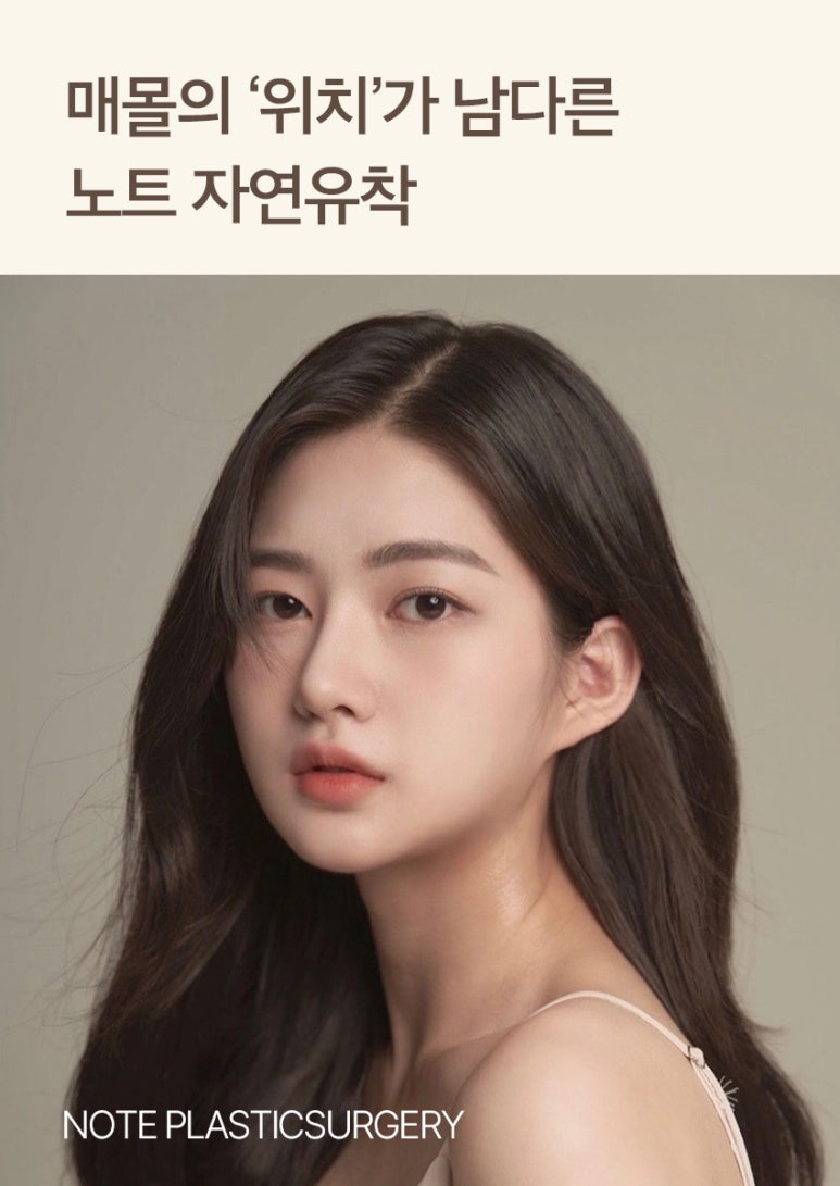 강남 눈성형 잘하는 곳, 노트성형외과의 자연유착 쌍꺼풀 수술 관련 이미지 4