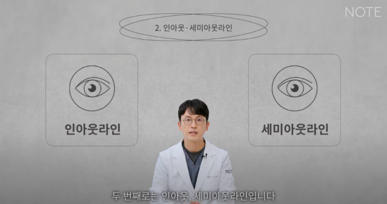 논현역 눈성형 잘하는 곳 노트성형외과의 인라인, 인아웃라인, 아웃라인 쌍꺼풀라인별 쌍꺼풀수술 후 느낌 미리보기 관련 이미지 8