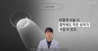 강남 눈성형외과 눈수술 잘하는 곳 논현역 노트성형외과의 쌍꺼풀수술 후 주의사항, 눈성형 후 렌즈 화장이 가능한 건 언제? 관련 이미지 4