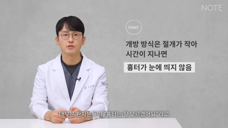 논현 코수술 코성형 유명한 곳 추천 강남 노트성형외과가 말하는 개방 코성형이란? 관련 이미지 5