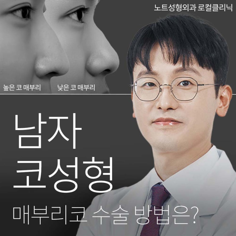 Gangnam Male Nose Surgery, Hump Nose Rhinoplasty, a Place Known for Good Natural Nose Surgery Recommendation: What Is the Hump Nose Surgery Method at Note Plastic Surgery in Nonhyeon? image 1