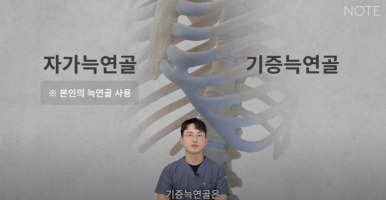 Recommended place for rhinoplasty in Gangnam: Nohyeon Note Plastic Surgery explains the difference between autologous rib cartilage and donated rib cartilage! image 4
