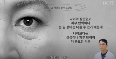 Gangnam Eye Plastic Surgery Clinic Famous for It: At Note Plastic Surgery near Nonhyeon Station, Is the Deciding Factor for Lower Eyelid Fat Repositioning and Lower Blepharoplasty the Elasticity Under the Eyes? image 18