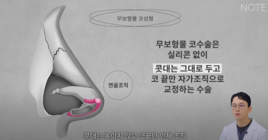 강남 코성형외과 코수술 잘하는 곳 추천 논현역 노트성형외과의 무보형물 자가연골 코성형수술로 자연스러운 코성형 관련 이미지 9