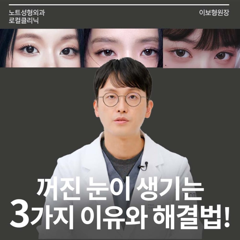 꺼진 눈이 생기는 이유는 따로 있다? 강남 눈성형 잘하는 곳 추천 노트성형외과의 눈꺼짐 해결을 위한 쌍커풀성형과 눈매교정, 지방이식수술 관련 이미지 1