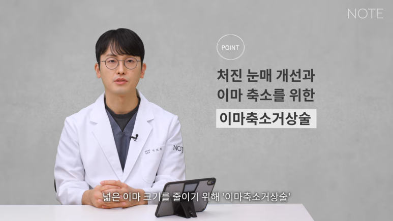 강남 안면거상 리프팅 잘하는 성형외과 추천 논현 노트성형외과의 안면거상 케이스 리뷰 수술 계획 관련 이미지 3