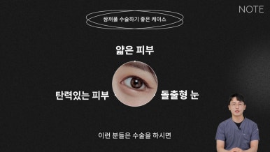 눈성형, 아직 고민 중이라면? 논현역 쌍꺼풀 수술 추천 병원 노트성형외과의 수술 후 예쁜 눈 미리 알기! 관련 이미지 8