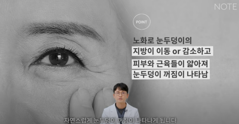 꺼진 눈이 생기는 이유는 따로 있다? 강남 눈성형 잘하는 곳 추천 노트성형외과의 눈꺼짐 해결을 위한 쌍커풀성형과 눈매교정, 지방이식수술 관련 이미지 19