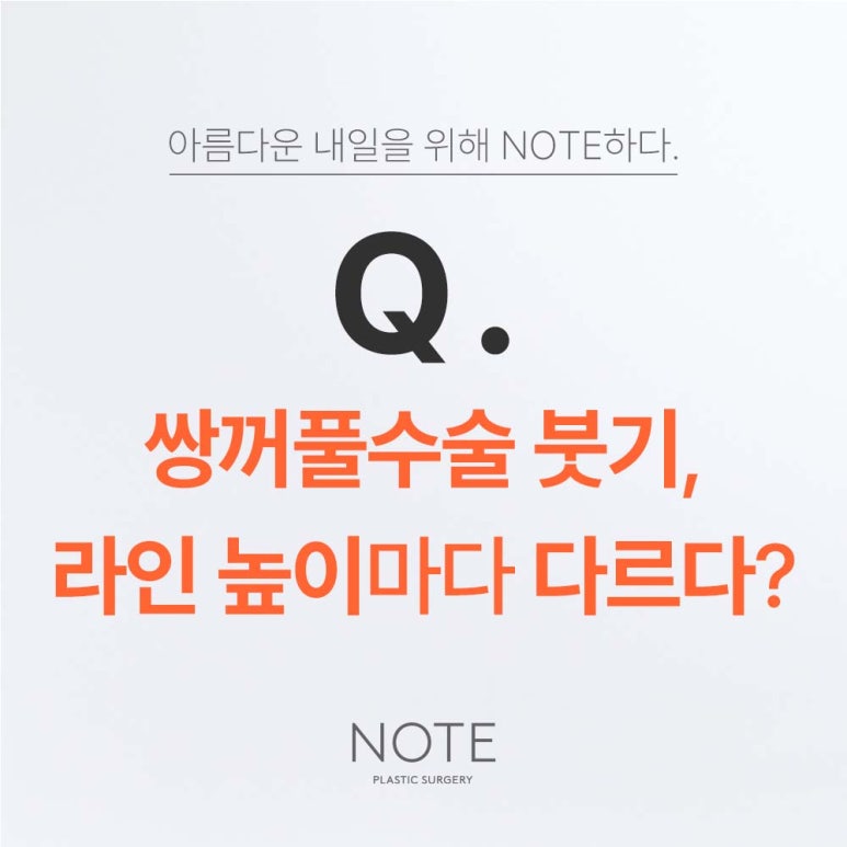 Gangnam Eye Plastic Surgery Clinic for Double Eyelid Surgery: Note Plastic Surgery’s Natural Adhesion, Buried Suture, In-Out Line Double Eyelid Swelling image 2