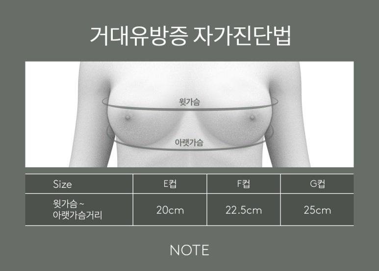 [Note Plastic Surgery] Let’s Learn About Breast Reduction! image 2