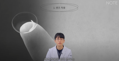 강남 눈성형외과 눈수술 잘하는 곳 논현역 노트성형외과의 쌍꺼풀수술 후 주의사항, 눈성형 후 렌즈 화장이 가능한 건 언제? 관련 이미지 3