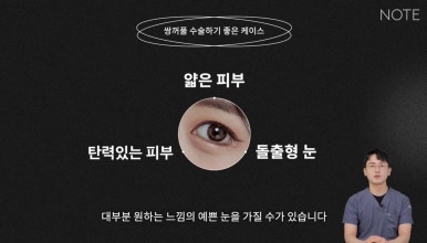 눈성형, 아직 고민 중이라면? 논현역 쌍꺼풀 수술 추천 병원 노트성형외과의 수술 후 예쁜 눈 미리 알기! 관련 이미지 9