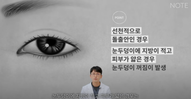 꺼진 눈이 생기는 이유는 따로 있다? 강남 눈성형 잘하는 곳 추천 노트성형외과의 눈꺼짐 해결을 위한 쌍커풀성형과 눈매교정, 지방이식수술 관련 이미지 23