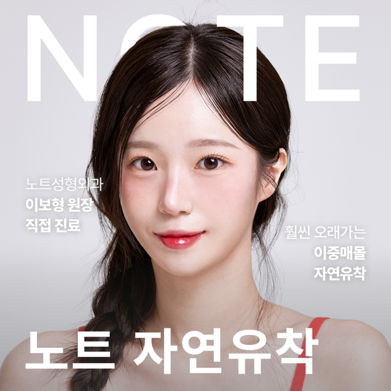 강남 눈성형 잘하는 병원, 자연유착 효과는? 노트성형외과의 오래가는 이중매몰 쌍꺼풀수술 관련 이미지 1