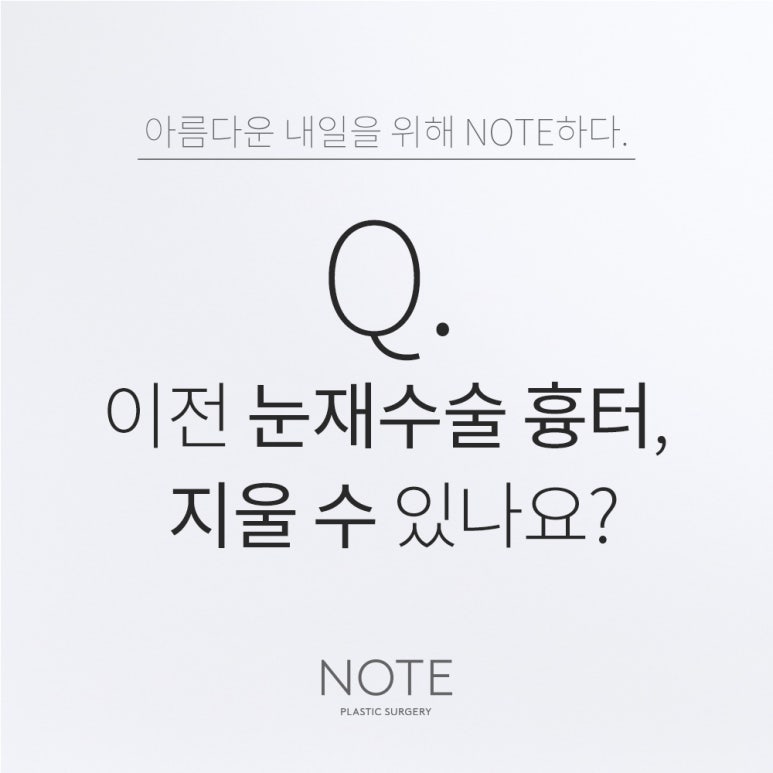 강남 눈재수술 쌍꺼풀 눈성형 잘하는 곳 추천 논현 노트성형외과의 이전 눈재수술 흉터 지울 수 있나요? 관련 이미지 1