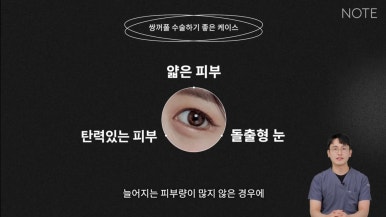 눈성형, 아직 고민 중이라면? 논현역 쌍꺼풀 수술 추천 병원 노트성형외과의 수술 후 예쁜 눈 미리 알기! 관련 이미지 7