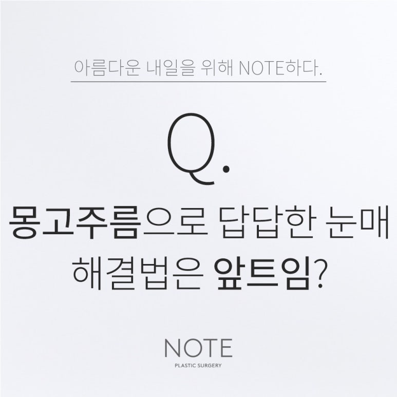 Gangnam Eye Plastic Surgery Clinic: Where to Get Double Eyelid Surgery and Epicanthoplasty Done Well. At Note Plastic Surgery in Nonhyeon, Is Epicanthoplasty the Solution to Concerns About Mongolian Folds? image 1